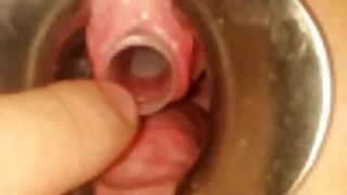 Ooooooo Nga xes phi